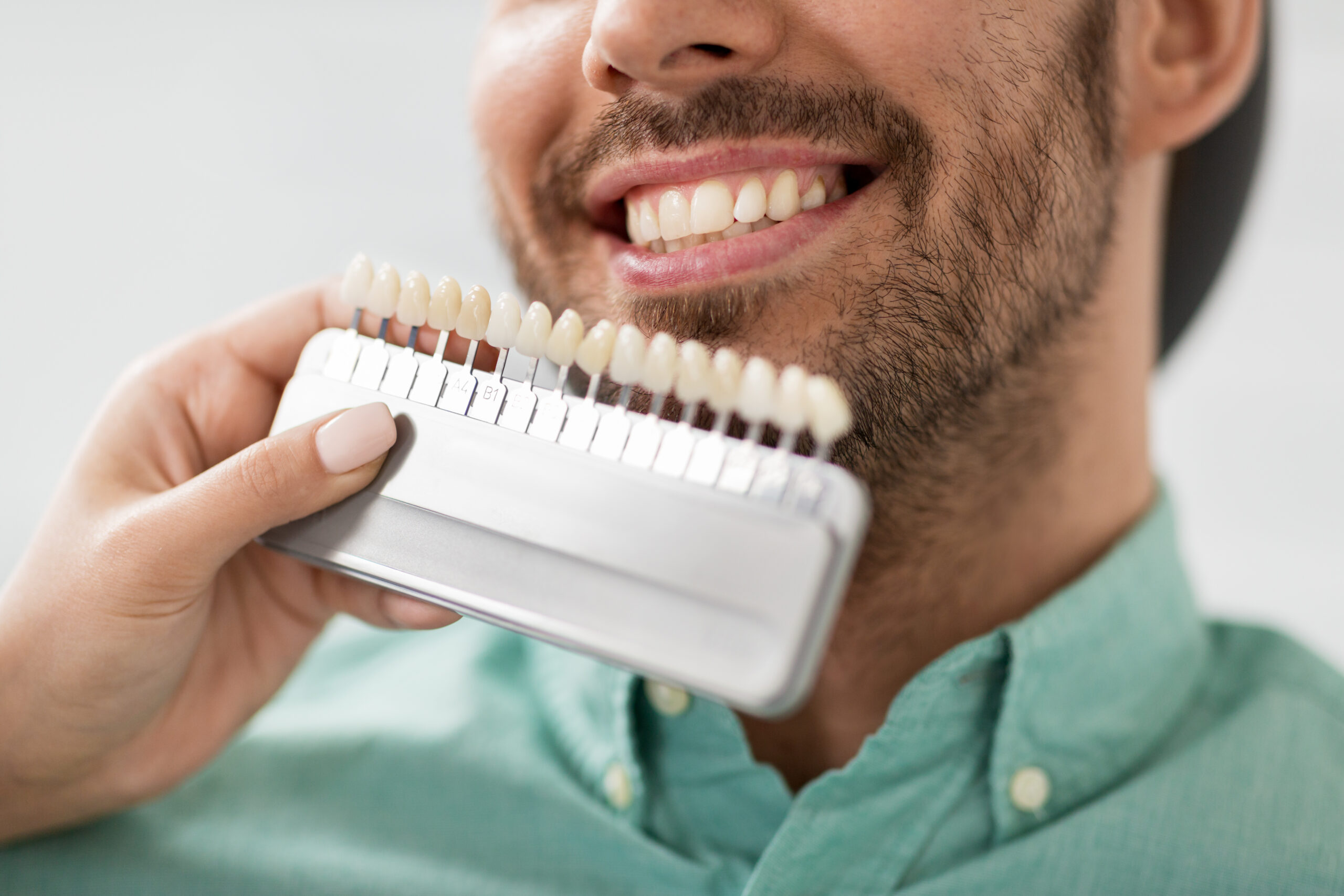 Close up of dentist with tooth color samples choosing shade for male patient teeth at St Catharines Dental Centre